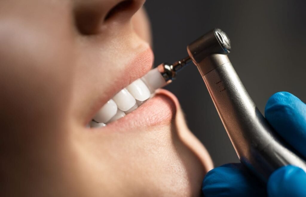 limpieza dental tijuana